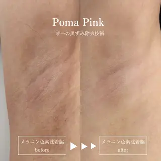 Raviy 【痩身専門・肌管理】のエステ・リラクイメージ