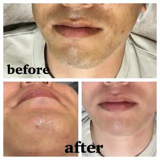 ゆいまーるはうす 脱毛南城市のエステ・リラクイメージ