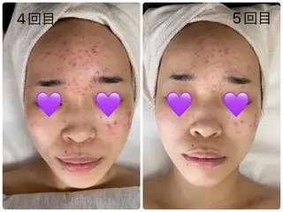 COCO beautyサロンのエステ・リラクイメージ