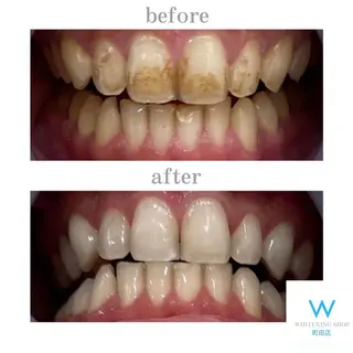 メンズ キッズ ホワイトニング ショップ町田店のその他イメージ