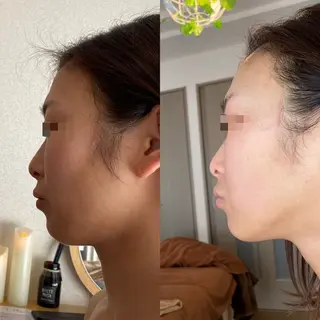 Meetite 小林のエステ・リラクイメージ