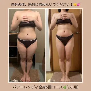 《本気痩せ×疲労改善 》  BILOOPのエステ・リラクイメージ