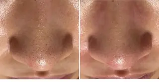 メンズ脱毛サロン X(エックス)のエステ・リラクイメージ