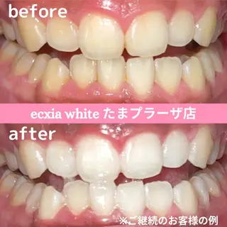 セルフホワイトニング　エクシアたまプラーザ店所属・yukari - オーナー -のその他イメージ