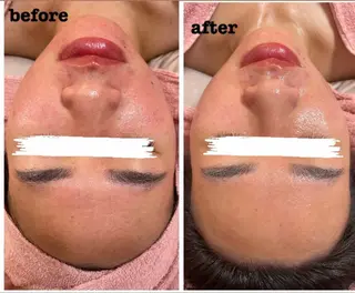 肌質改善専門店/絹々(きぬ)所属・心満たされる ハーブピーリング絹々のエステ・リラクイメージ