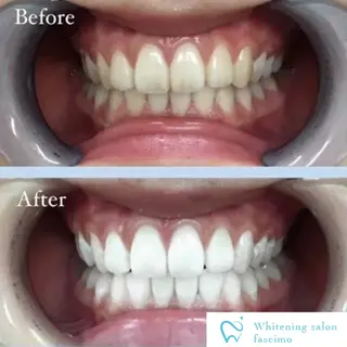 ホワイトニングサロン fascimo新座店のその他イメージ