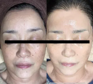 代表 MOMOのエステ・リラクイメージ