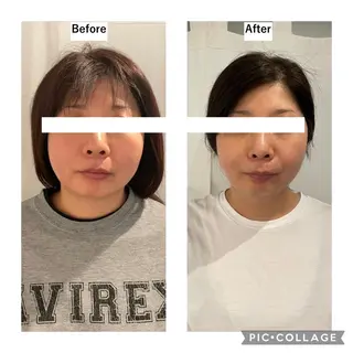 12Dハイフ💗 最強小顔のエステ・リラクイメージ