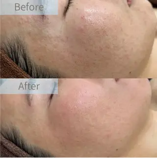 ♡RAYVIS♡ 名古屋店　神田のエステ・リラクイメージ