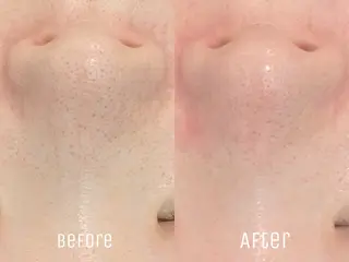 ニキビ・毛穴・肌荒れ &me 西宮北口店のその他イメージ