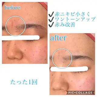 ミディアム カラー パーマ ヘアアレンジ キッズ ネイル マツエク・マツパ EnsorClair 代表 野口真央のエステ・リラクイメージ