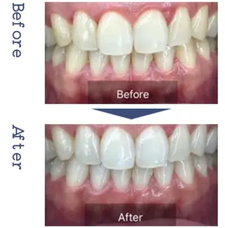 enu beauty salonのマツエク・マツパデザイン