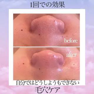 3glitter 肌質改善＆痩身のエステ・リラクイメージ