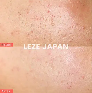 LA CLARTE所属・LA CLARTEのエステ・リラクイメージ