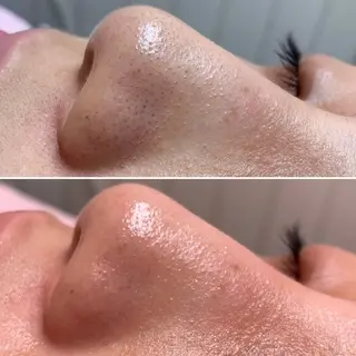 White labo 🌿AKANEのその他イメージ