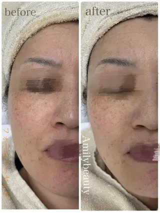 Amily beauty 毛利のエステ・リラクイメージ