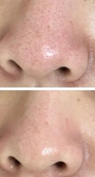 メンズ 朝重い人専用 肩甲骨調整のエステ・リラクイメージ