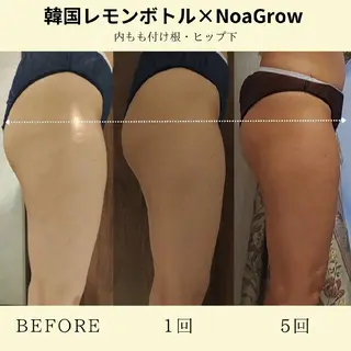 痩身小顔専門 アマテ ビューティー.Nのエステ・リラクイメージ