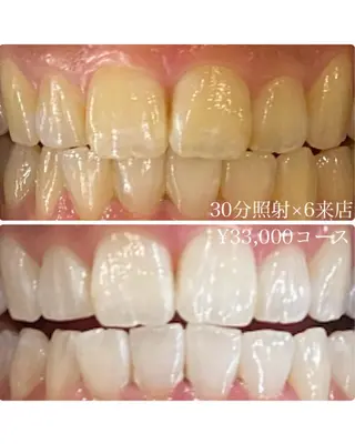 メンズ ホワイトニング ルーム　川崎店のその他イメージ