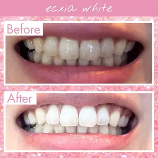 セルフホワイトニング エクシア仙台駅東口店のその他イメージ