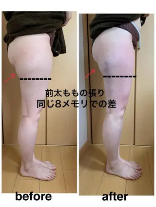 痩身/脱毛/ネイル HARUKAのエステ・リラクイメージ