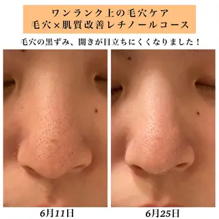 Bellesthe (ベルエステ)のエステ・リラクイメージ