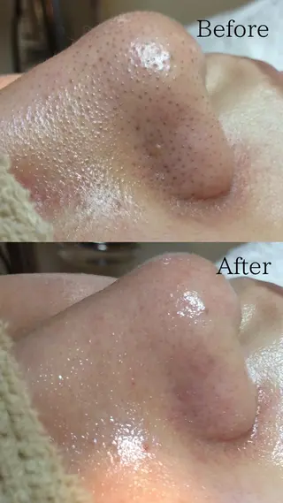 エステサロン Lazulisea所属・川口 春奈のエステ・リラクイメージ