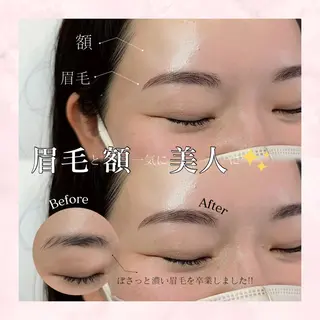アイブロウ Lea堺東　毛穴洗浄 ×顔ワックス脱毛のエステ・リラクイメージ