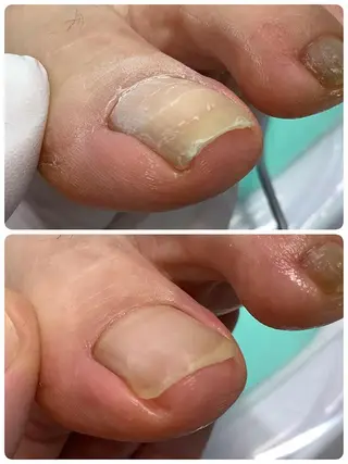 東京巻き爪 アカデミーのエステ・リラクイメージ