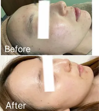 高崎トリニティ接骨院所属・舘野 はるかのエステ・リラクイメージ