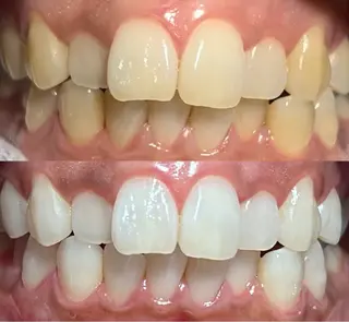 io teeth careのその他イメージ