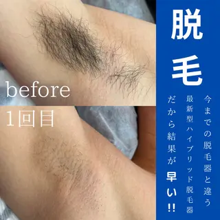 WAX・肌質改善・毛 穴洗浄/林愛真のエステ・リラクイメージ