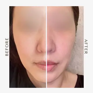 be living 真実のエステ・リラクイメージ