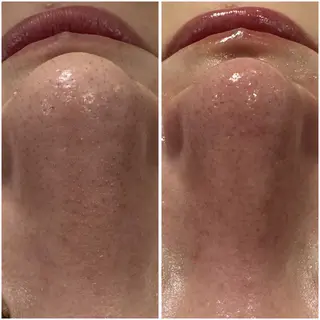 肌質改善サロン Manaririoのエステ・リラクイメージ