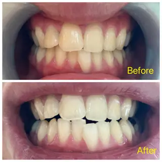 M渋谷 ホワイトニングのエステ・リラクイメージ