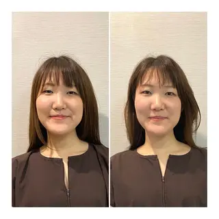 即小顔♥️美容鍼× ハーブピーリングのその他イメージ