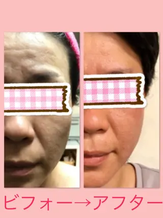 CrownJewel クラウン ジュエルのエステ・リラクイメージ