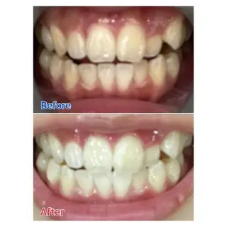 M渋谷 ホワイトニングのエステ・リラクイメージ