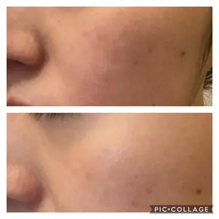 メンズ 朝重い人専用 肩甲骨調整のエステ・リラクイメージ