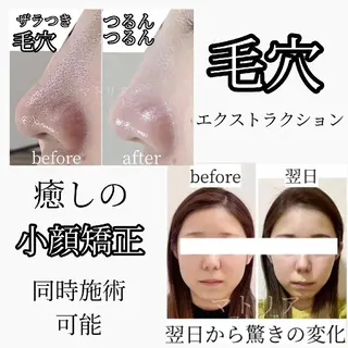 小顔と美肌 まごころエステMatoria所属・小顔 美肌専門 Matoriaのエステ・リラクイメージ