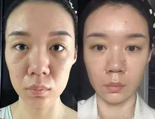 aliaハーブ水光店 エステティシャン募集のエステ・リラクイメージ