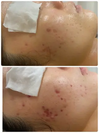 吉祥寺エステサロン Orangeのエステ・リラクイメージ