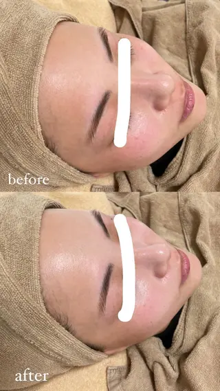 エステサロン Mi-mi.iのエステ・リラクイメージ