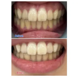 M渋谷店所属・M渋谷 ホワイトニングのエステ・リラクイメージ