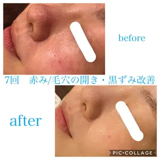 ロング カラー パーマ ヘアアレンジ ネイル マツエク・マツパ EnsorClair 代表 野口真央のエステ・リラクイメージ
