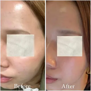 Tulipe Chihoのエステ・リラクイメージ