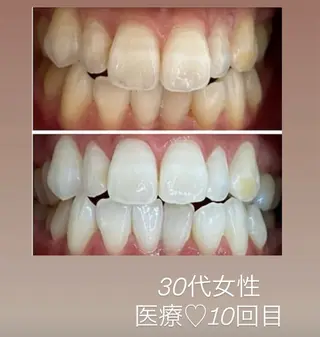 Kaula ホワイトニング🦷✨のエステ・リラクイメージ