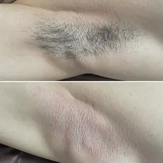 アイブロウ メンズ キッズ Epina 千葉店 【エピナ】のエステ・リラクイメージ