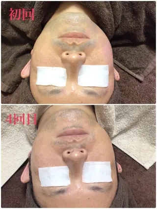 メンズ LANA所属・エステサロン LANA.のエステ・リラクイメージ