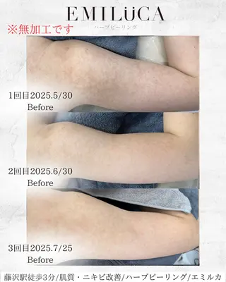 ハーブピーリング専門EMILUCA藤沢所属・ハーブピーリング /KAEDEのエステ・リラクイメージ